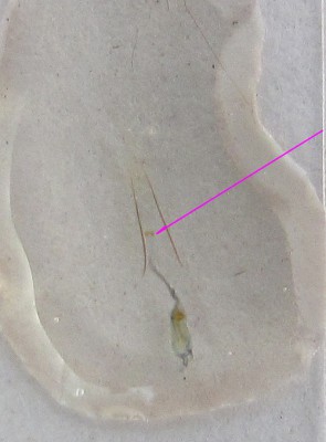genitalia samicy, widoczne dwie płytki w przewodzie torebki kopulacyjnej